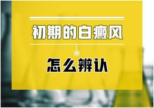 白癜風初期是什么樣的